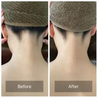 美肌脱毛&光ﾌｪｲ ｼｬﾙ🌸CLEVYのエステ・リラクイメージ