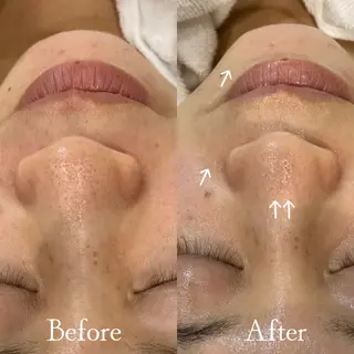 Del'm豊橋所属・豊橋De'Im 安部のエステ・リラクイメージ