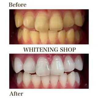 ホワイトニング ショップ川越店のエステ・リラクイメージ