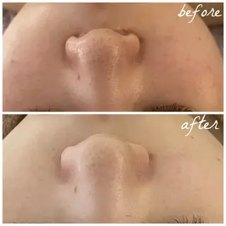 メンズ メナード岐阜市茜部 杉浦のエステ・リラクイメージ