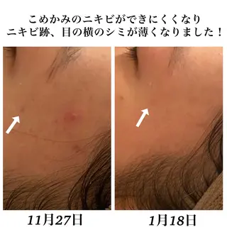 Bellesthe （ベルエステ）のエステ・リラクイメージ