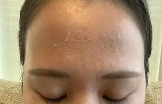 肌質改善サロンChouChou所属・肌質改善サロン chouchouのエステ・リラクイメージ