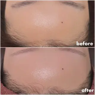 REVE （レーヴ）のマツエク・マツパデザイン