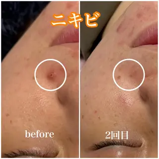 毛穴レス ハーブ＆ ワックス脱毛×光脱毛のエステ・リラクイメージ