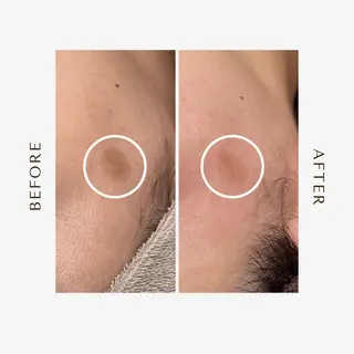 1st｜フェイシャル エステ専門店のエステ・リラクイメージ