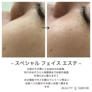 ビューティー ミロワールのエステ・リラクイメージ