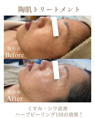 フェイシャルサロンLusis所属・肌質改善専門サロン Lusisのエステ・リラクイメージ