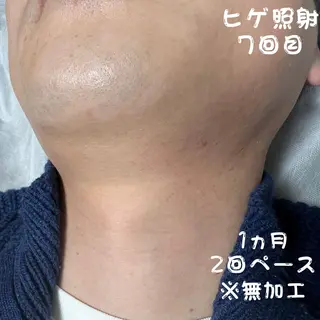 メンズ キッズ メンズ脱毛　FELISSE【フェリッセ】所属・メンズ脱毛フェリッセ /男女🆗キッズ🆗のエステ・リラクイメージ