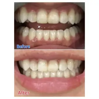 M渋谷店所属・Ｍ渋谷 ホワイトニングのエステ・リラクイメージ