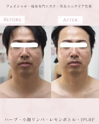 メンズ ユニセックスエステサロンUniclear所属・痩身&フェイシャル Uniclearのエステ・リラクイメージ