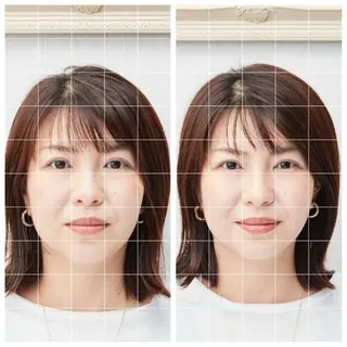 美容鍼　蒼月-aotsuki-所属・美容鍼「蒼月」 -アオツキ-のエステ・リラクイメージ