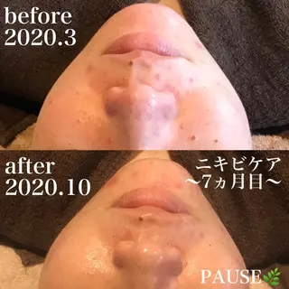 浜野 恵美のエステ・リラクイメージ