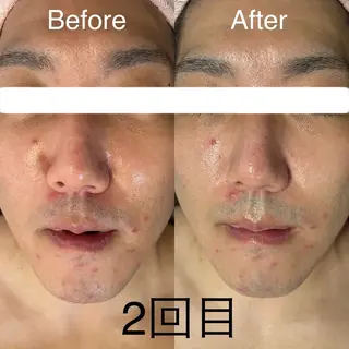 Relaxation SalonARONAのエステ・リラクイメージ