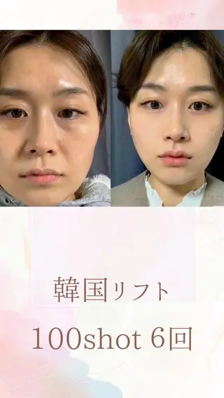 マツエク・マツパ 愛維美水光美肌専門店所属・愛維美水光美肌専門店 メンズレディースokのエステ・リラクイメージ