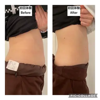 12Dハイフ💗 最強小顔のエステ・リラクイメージ