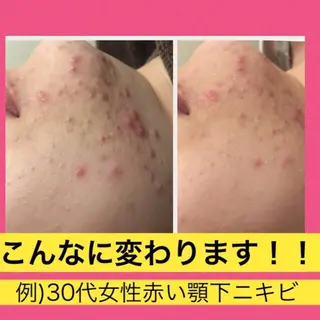 ミディアム カラー パーマ ヘアアレンジ メンズ キッズ ネイル マツエク・マツパ ニキビ・肌質改善専門 ♡人生が変わるサロンのエステ・リラクイメージ