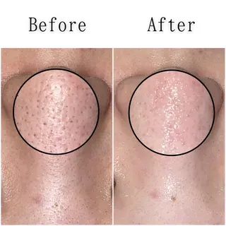 シミ・毛穴専門店 gracia 宇土店所属・シミ・毛穴専門店 /gracia 安藤のエステ・リラクイメージ