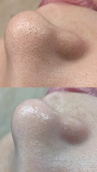 Facial Salon LUIRE所属・LUIRE　 ルイールのエステ・リラクイメージ