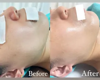 都度払い制脱毛サロンBe Charm所属・Be Charm 山﨑のエステ・リラクイメージ