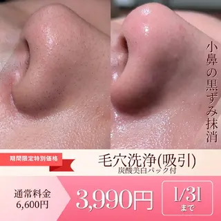 Morphome所属・【Morphome】 hinaのエステ・リラクイメージ