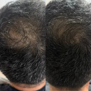 メンズ Rairy所属・Rairy Salon富士見町のエステ・リラクイメージ