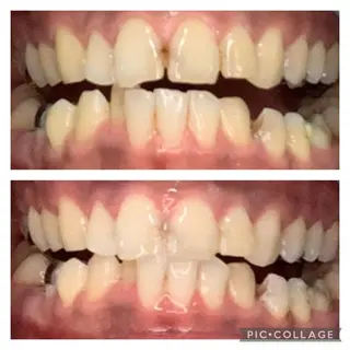 メンズ ヒーリングサロン メリッサ/tooSMILE所属・大屋 詩織のエステ・リラクイメージ