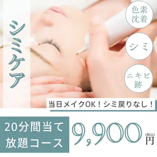 肌質改善ピーリング ✧BestBelleのエステ・リラクイメージ