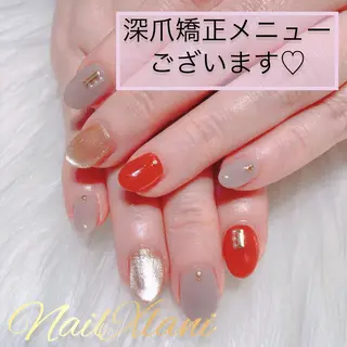 ネイル Nail×Lani 深爪矯正対応◎のネイルデザイン