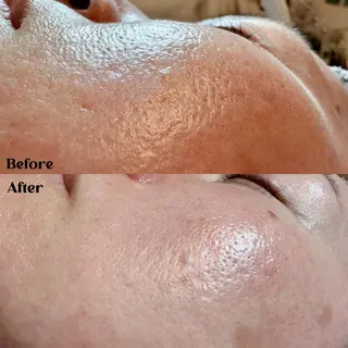 Hit. シュガーリング豊橋のエステ・リラクイメージ