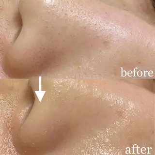 毛穴専門サロン　フルール所属・フルールFululu 自由が丘のエステ・リラクイメージ