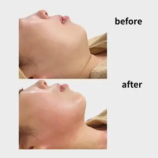 看護師 AYUIのエステ・リラクイメージ