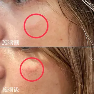 痛くないシミ取り 【荻窪】石橋のヘアスタイル