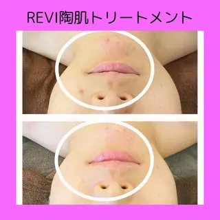 赤澤/本気痩せ・脱毛 ・ノーファンデ肌のその他イメージ