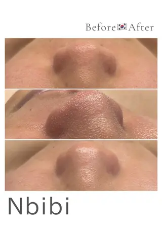 韓国🇰🇷価格 サロン_Nbibiのエステ・リラクイメージ