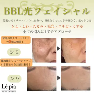 肌質管理専門店 Lé pia　AMIのエステ・リラクイメージ