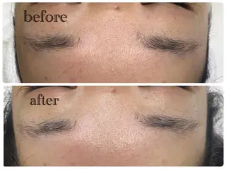 デ・アイム新潟北所属・サイトウ .のエステ・リラクイメージ