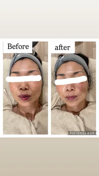 Beautysalon  R's所属・栗本 瞳のエステ・リラクイメージ