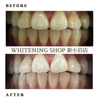 メンズ ホワイトニング ショップ新小岩店のその他イメージ