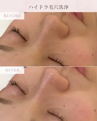 beauty salon Clochette所属・clochette misakoのエステ・リラクイメージ