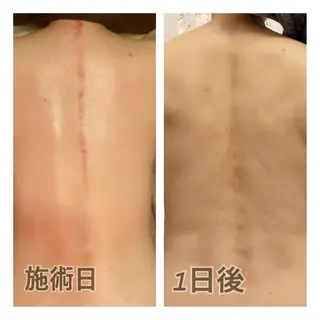 美腸専門 漢方よもぎ蒸しのエステ・リラクイメージ