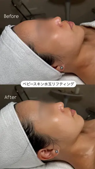 韓国肌管理🫧LDM 🫧Junnaのエステ・リラクイメージ