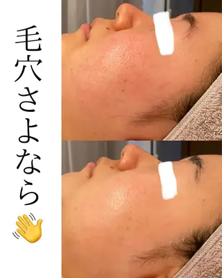 田中For..天王寺 肌質改善/よもぎ蒸しのエステ・リラクイメージ