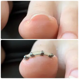 ネイル HANA │ネイルのネイルデザイン