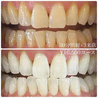 メンズ ホワイトニングルーム　川崎店所属・ホワイトニング ルーム　川崎店のその他イメージ