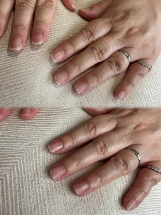 ネイル Salon de A所属・【美肌専門店】 Salon de Aのエステ・リラクイメージ