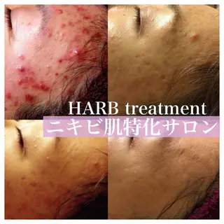 【代謝×免疫UP】お肌と身体のオールハンド専門店estheya sign所属・オールハンド専門店 【リンパ×ヘッド】のエステ・リラクイメージ