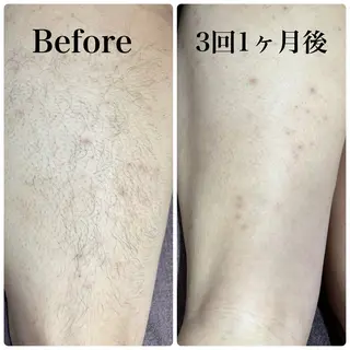 メンズ 片田 ゆいのエステ・リラクイメージ