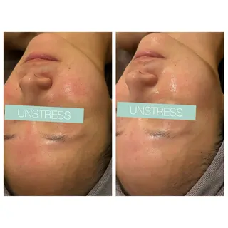 ☆痩身/小顔☆ 結果出します☆のエステ・リラクイメージ