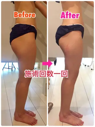 ロング カラー パーマ ヘアアレンジ メンズ キッズ ネイル マツエク・マツパ ‍痩身＆ボディ 結果出し🌟丹野のエステ・リラクイメージ