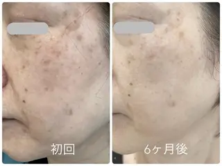 エステティックサロン ベルネのエステ・リラクイメージ